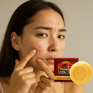 Femme montrant son acné, savon thaï contre les boutons, emballage rouge et jaune visible.