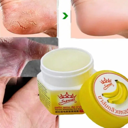 Baume hydratant Supreme à la banane présenté avec des photos avant/après montrant la réparation de talons secs et craquelés. L’image met en avant un soin nourrissant destiné à adoucir la peau abîmée des pieds et des mains, avec une texture riche et réparatrice.