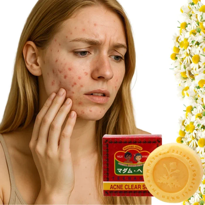 Jeune femme au teint acnéique avec un savon Madame Heng Acne Clear et des fleurs de camomille.