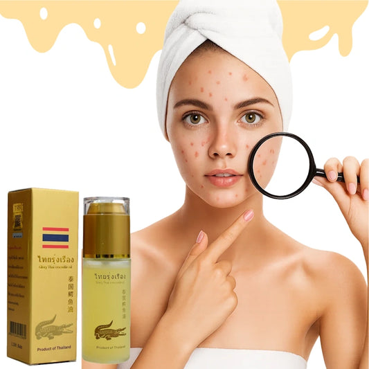 Jeune femme au visage acnéique, tenant une loupe, avec une bouteille d'huile Glory.