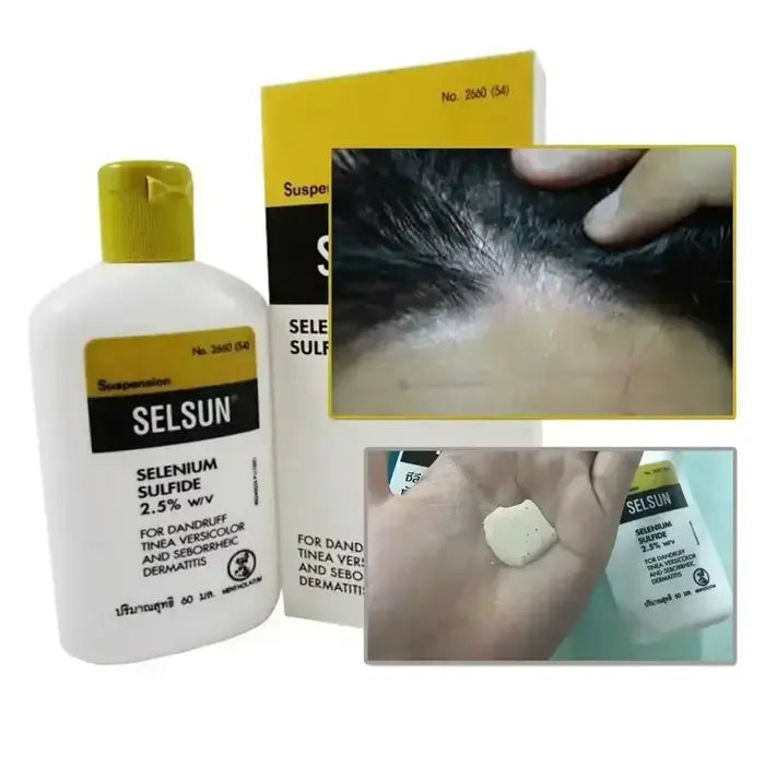 Shampoing Selsun au sulfure de sélénium 2,5 % contre pellicules, teignes et dermatites séborrhéiques.