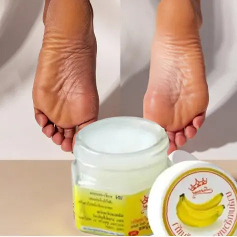 Baume Hydratant Supreme Banane – Avant/après : talon gercé très sec et talon réparé lisse