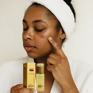 Femme avec marque rouge visage appliquant sérum huile crocodile pour atténuer cicatrices et imperfections.