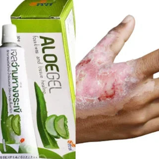 Gel d'aloe vera en tube vert pour la soigner une main avec les irritations