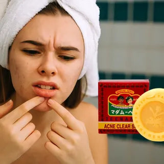 Una giovane donna osserva la sua acne davanti a un sapone alle erbe tailandese contro l’acne.