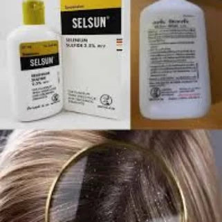 Produits de soin capillaire Selsun et mèche de cheveux.