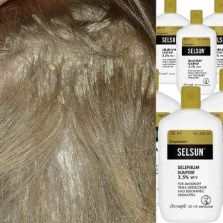 Des bouteilles de shampooing Selsun ainti-pelliulaire et cheveux secs et ternes à cause des problèmes de pellicules