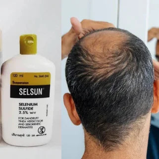 Un flacon de Shampoing Selsun topique pour les soins capillaires