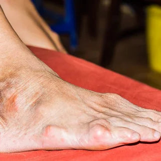 Des pieds avec des signes de gouttes sur une surface rouge.