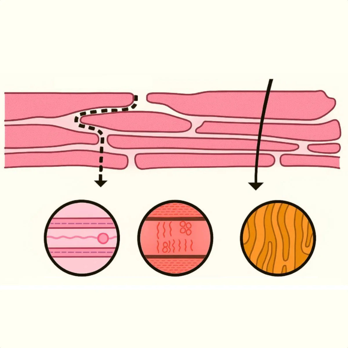 Douleurs Musculaires et Fatigue