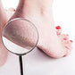 Gros plan sur un talon sec observé à la loupe, montrant des fissures et une peau rugueuse. L’image illustre un problème de sécheresse du pied et met en avant la nécessité d’un soin réparateur Supreme pour hydrater et lisser la peau.