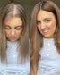 Neo Hair Lotion Tonic - Anti Perte des Cheveux 