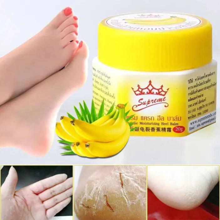 Baume hydratant Supreme pour talons, présenté avec des bananes et des images illustrant la réparation de la peau sèche et craquelée. L’image met en avant un soin nourrissant destiné à adoucir, lisser et protéger les pieds et les mains grâce à une formule riche et réparatrice.