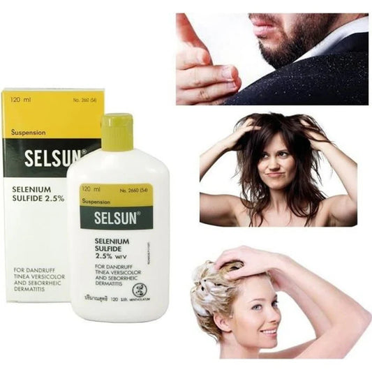 120 ml de shampooing antipelliculaire Selsun sulfure 2,5% dermatite fongique, Anti-pellicule, Anti-chute des cheveux 